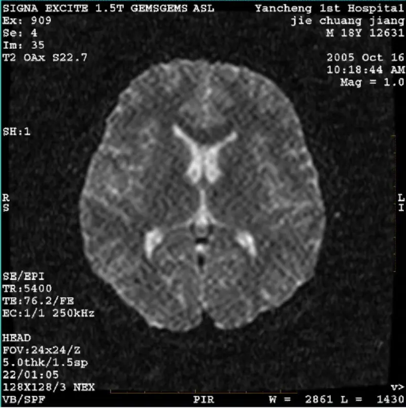 ARTIFACT WI/Fiesta ရုပ်ပုံ အဖြူရောင် Pixel